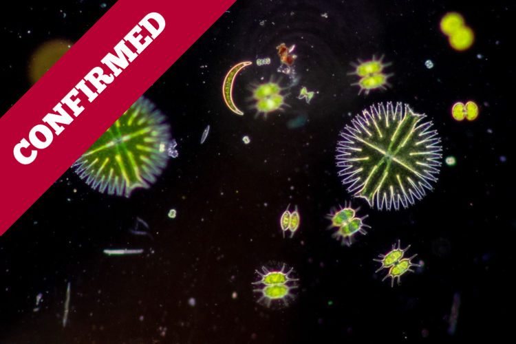 Wastewater Bacteria