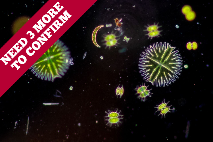 Wastewater Bacteria